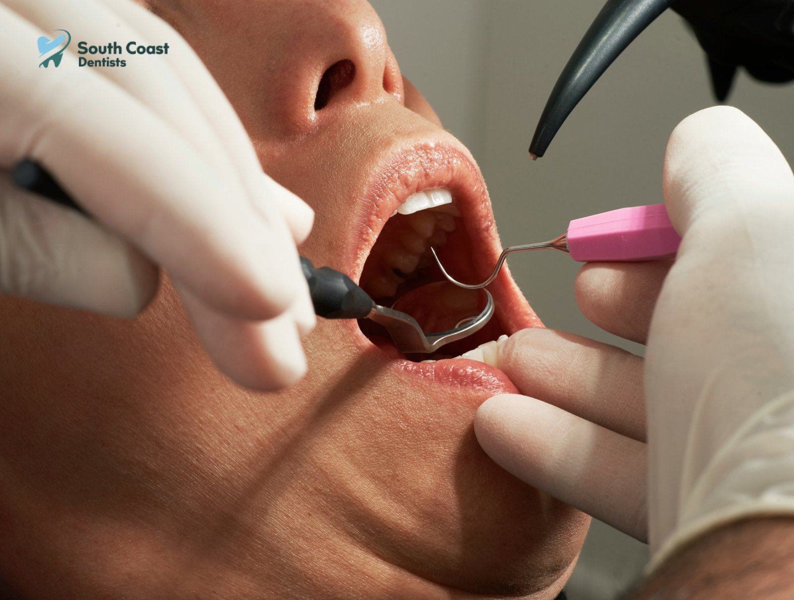 Understanding Different Types of Cosmetic Dental Procedures